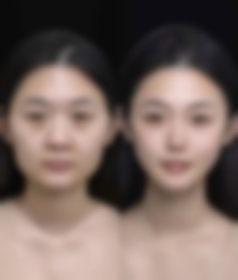 深圳正得瑧湾整形医院口碑评价怎么样？