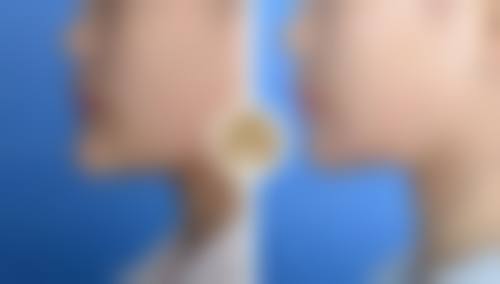 南昌鹏爱美容整形医院何贵生医生患者评价