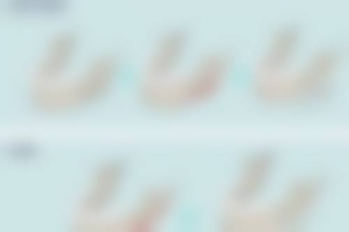 广州新发现植发医院黄香枚医生睫毛种植技术怎么样?