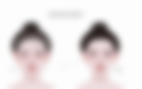 抽脂手术前需要注意什么？