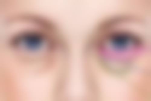 宜昌华美整形美容医院罗广杰医生鼻整形技术怎么样？