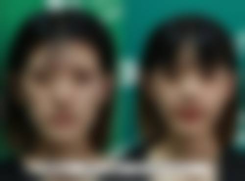 除了正常修复反应，还有哪些原因会导致肿胀呢？