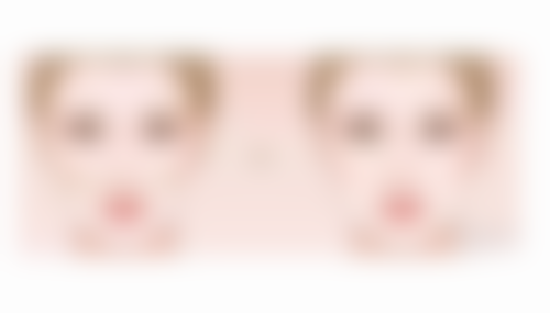 上海迈享汇优嘉整形医院正规吗?