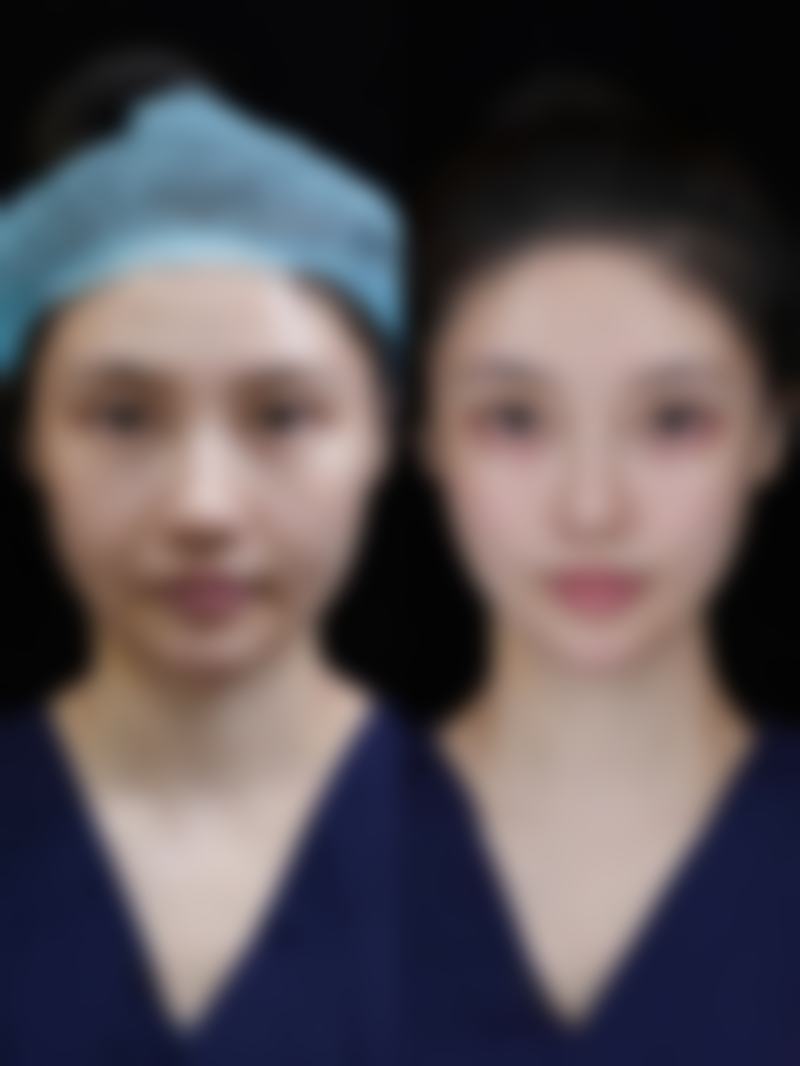 物理治疗有哪些方式?