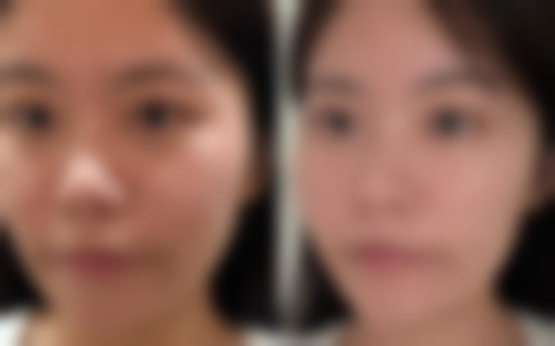 广州尚美善造医疗美容门诊部邵方医生患者评价