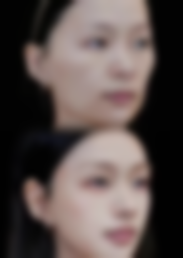 宜昌华美整形美容医院罗广杰医生擅长项目