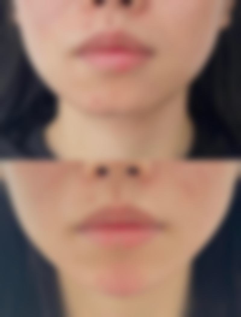 北京金炫澈整形美容医院金炫澈医生预约挂号指南