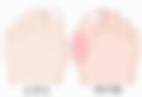 影响隆胸假体修复期的关键因素有哪些？