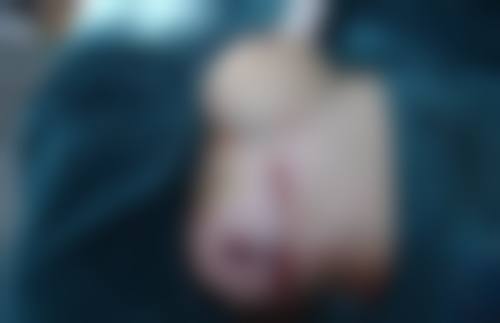 深圳芝华医疗美容医院口碑评价怎么样?