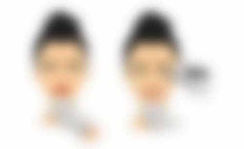 影响隆鼻多年后状态的相关因素有哪些？