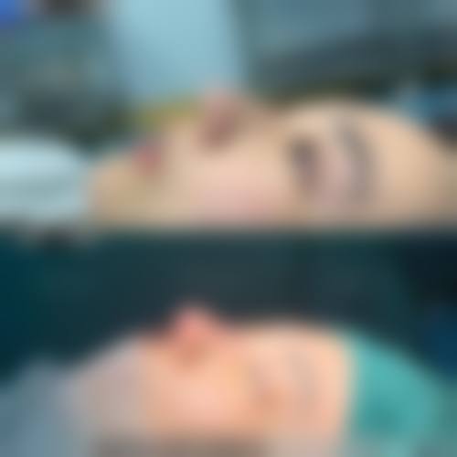 深圳阳光医疗美容医院汤莉莉医生擅长项目