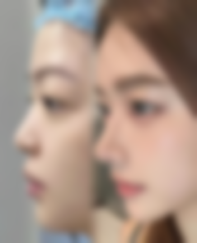 南宁伊莱美医疗美容门诊部正规吗？