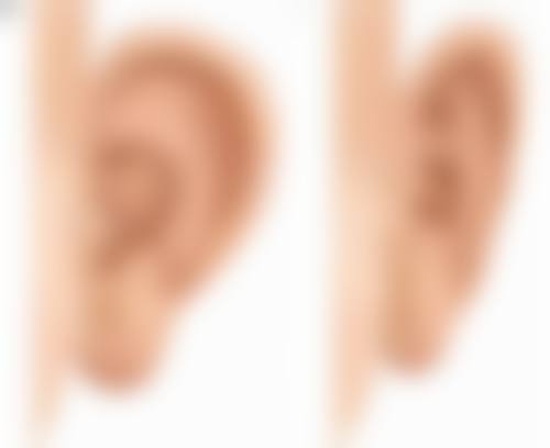 吸脂丰臀有效果吗？揭秘真实案例与专家见解！答案是有，效果持久且自然美观！ 