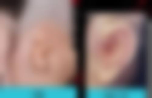 宁波鄞州芬迪医疗美容诊所口碑评价怎么样?