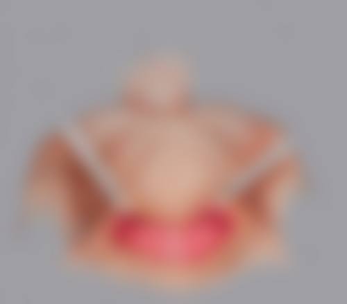 割双眼皮手术前需要做哪些准备?