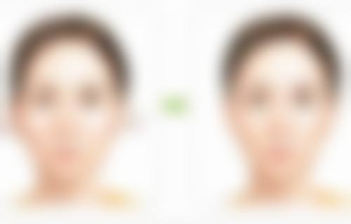 韩国Dr.jin's鼻整形医院正规吗？