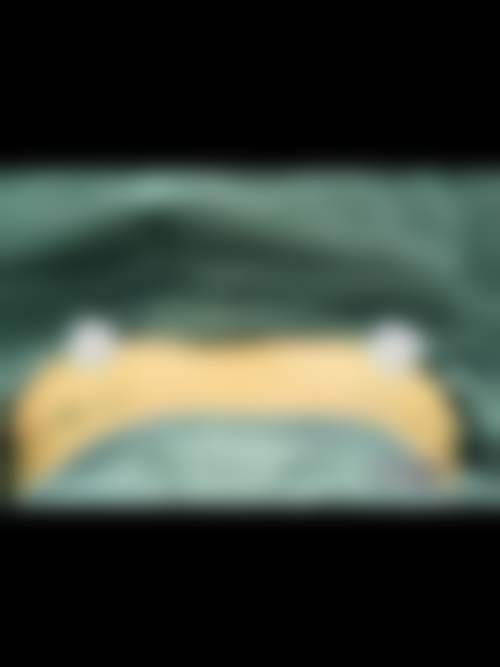 深圳阳光医疗美容医院罗秀芬医生患者评价