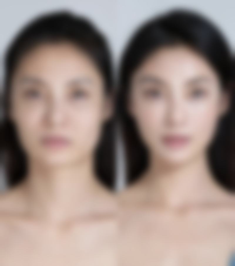 为什么有人会选择吸脂丰臀手术？