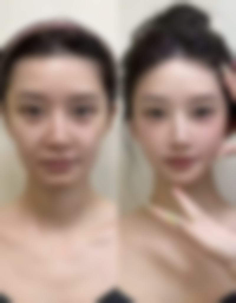 福州新世纪整形医院怎么预约