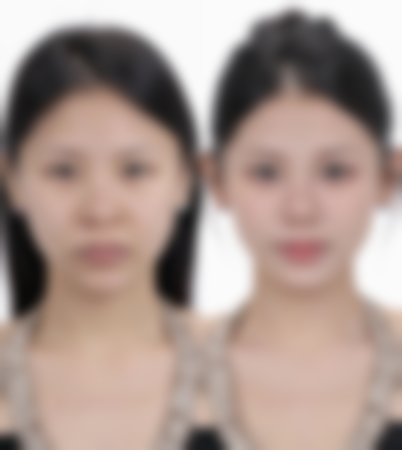 南宁东方医疗美容专科医院正规吗？