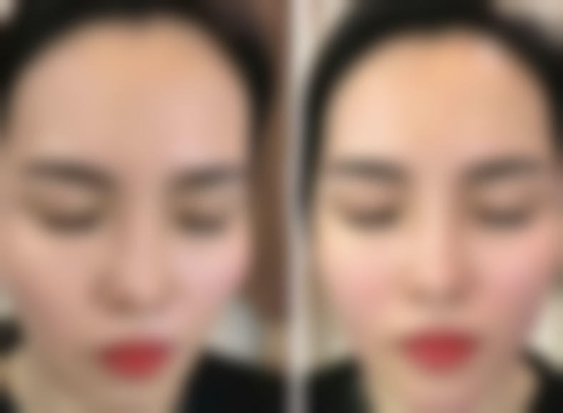 济南林之青整形医院正规吗？