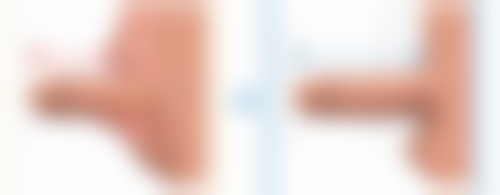 北京五维医疗美容门诊部陈冠.军 医生颌骨矫正技术怎么样？