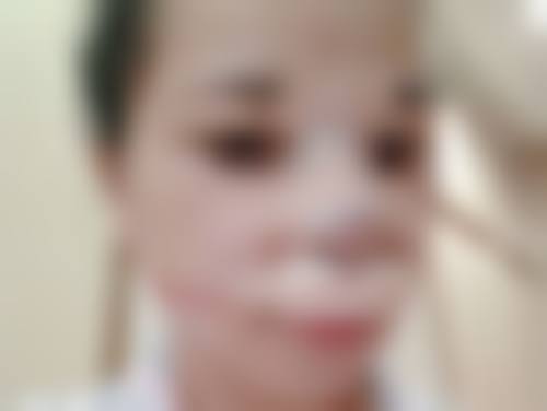 哈尔滨禾力康医疗美容医院所健鹏医生患者评价