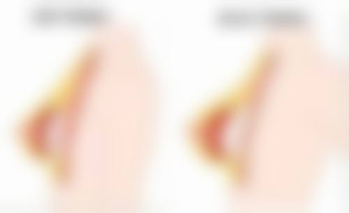 lsw皮肤科口碑评价怎么样？