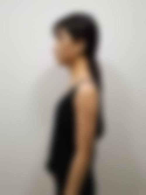 深圳阳光医疗美容医院安浩军 医生擅长项目