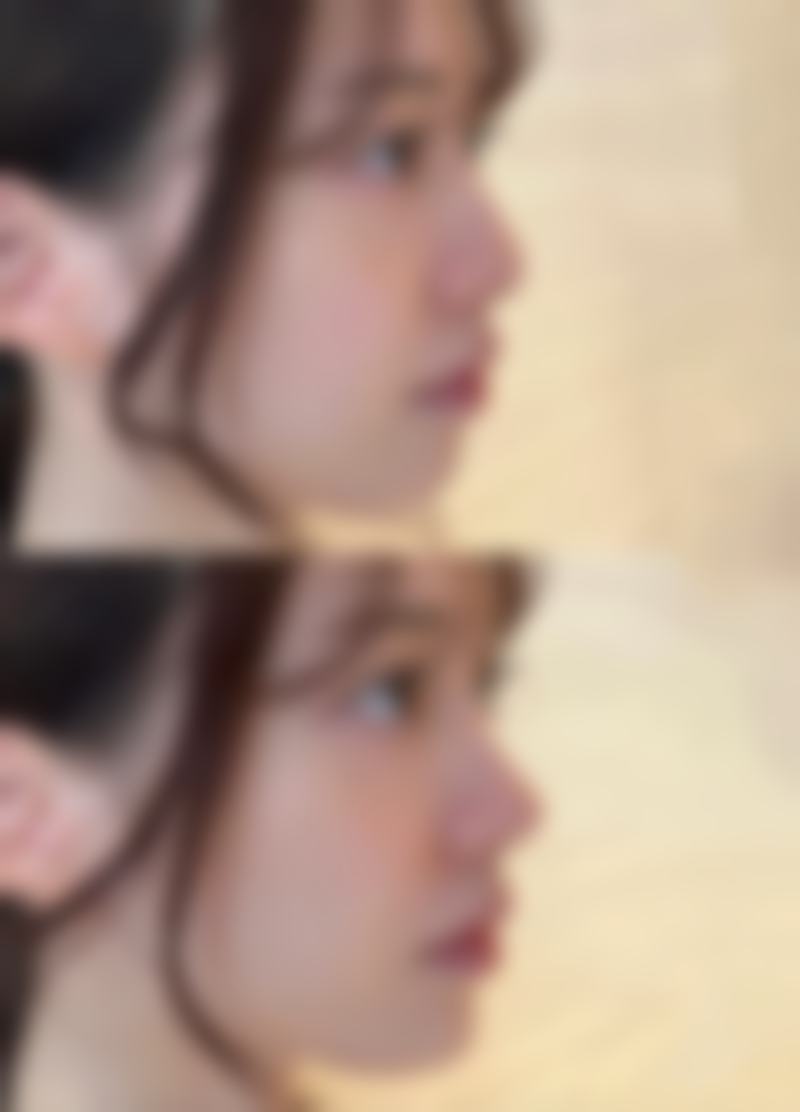 湘西赫美医疗美容怎么预约：