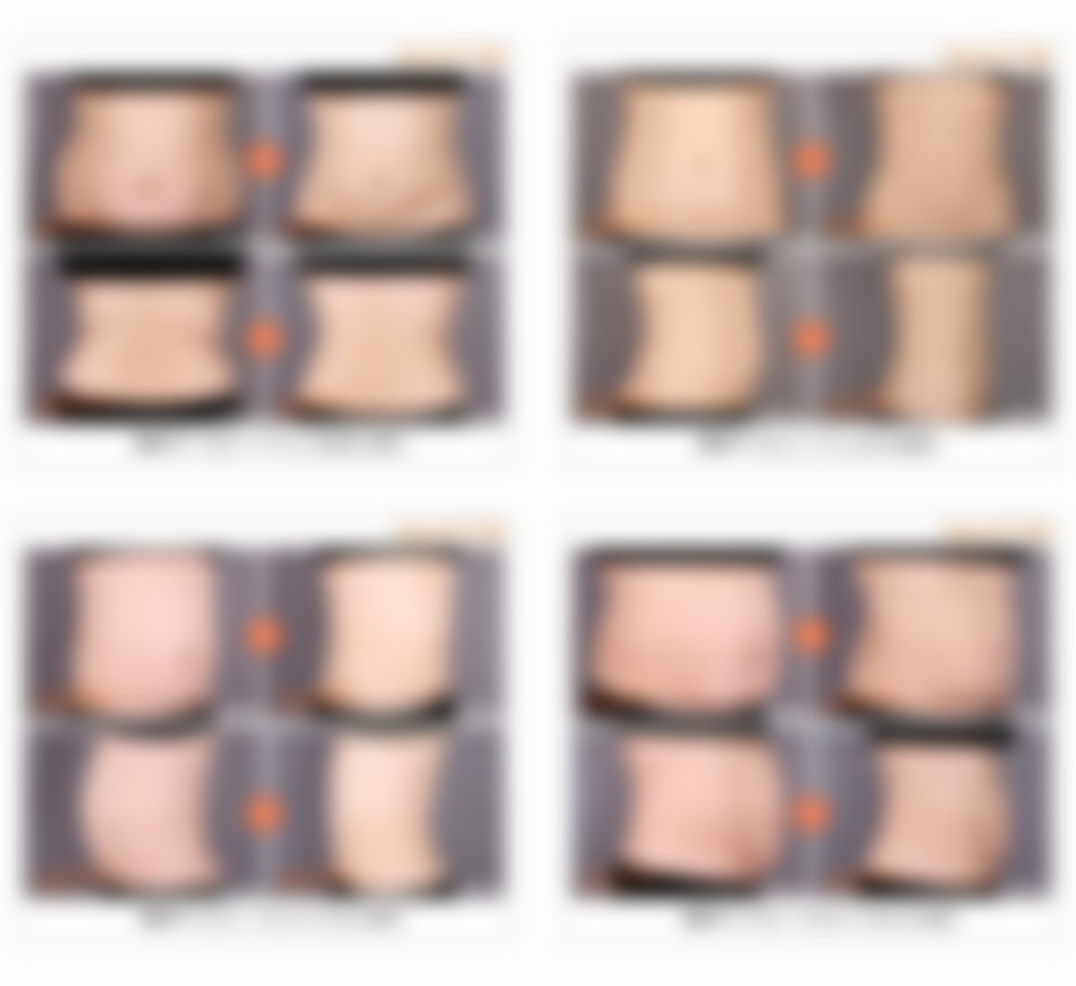 韩国365mc吸脂医院宋秉哲（釜山院）医生擅长项目