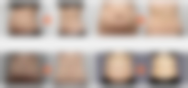 韩国365mc吸脂医院朴惠贞（大邱院）医生预约挂号指南