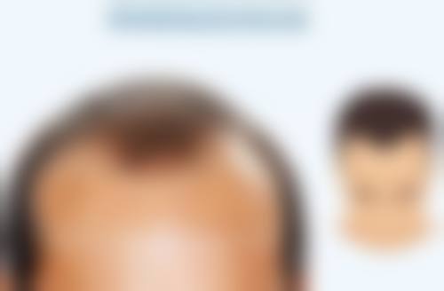 上海安禾美阁医疗美容门诊部(原美丽之星)冯新青医生患者评价