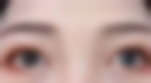 手术方式对备孕时间有什么影响？