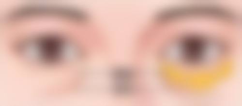 广州雪儿海蒂女性私密整形修复专科陈伟芳医生擅长项目