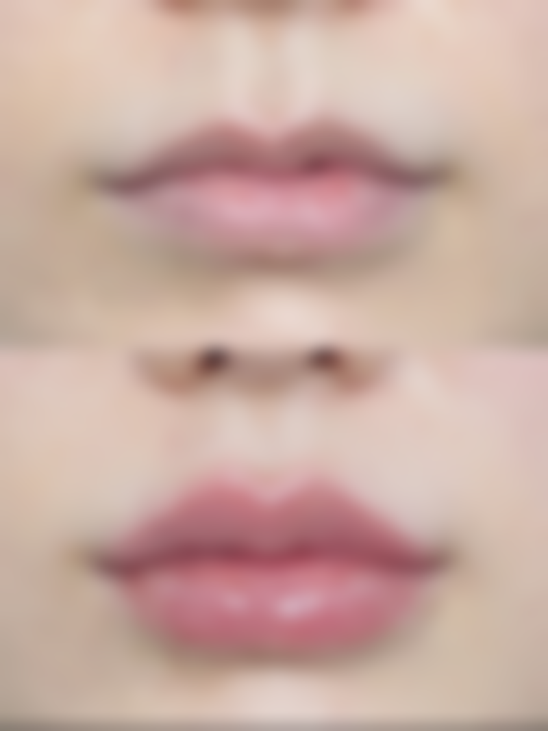 广州雪儿海蒂女性私密整形修复专科陈伟芳医生预约挂号指南