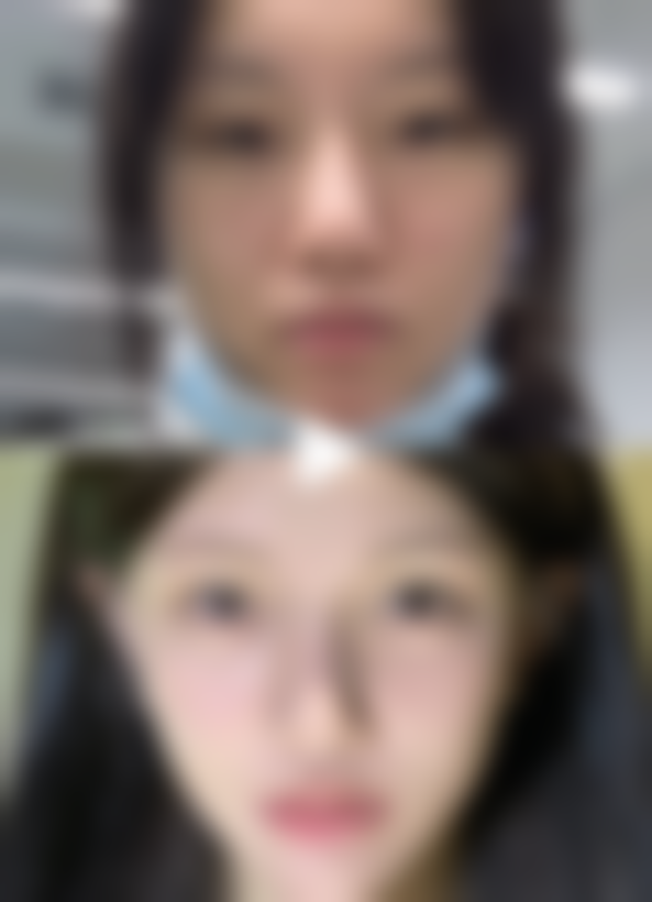 广州雪儿海蒂女性私密整形修复专科陈伟芳医生收费价格