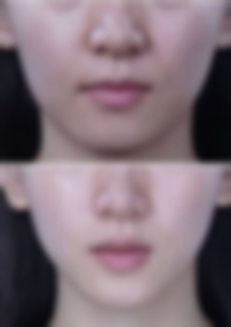 方法二：物理治疗如何发挥作用？