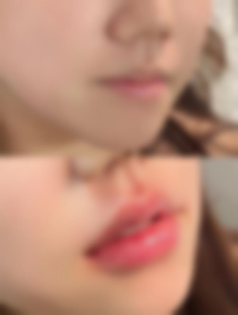 遵义医学校附属医院美容医院怎么预约