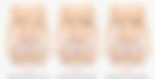 西安美立方医疗美容医院李蓉华医生瘦小腿技术怎么样？