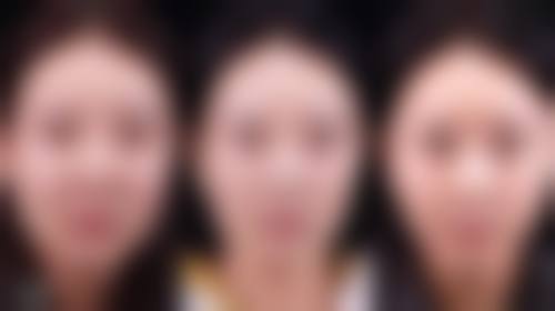 常州璟尼曼医疗美容门诊部口碑评价怎么样？