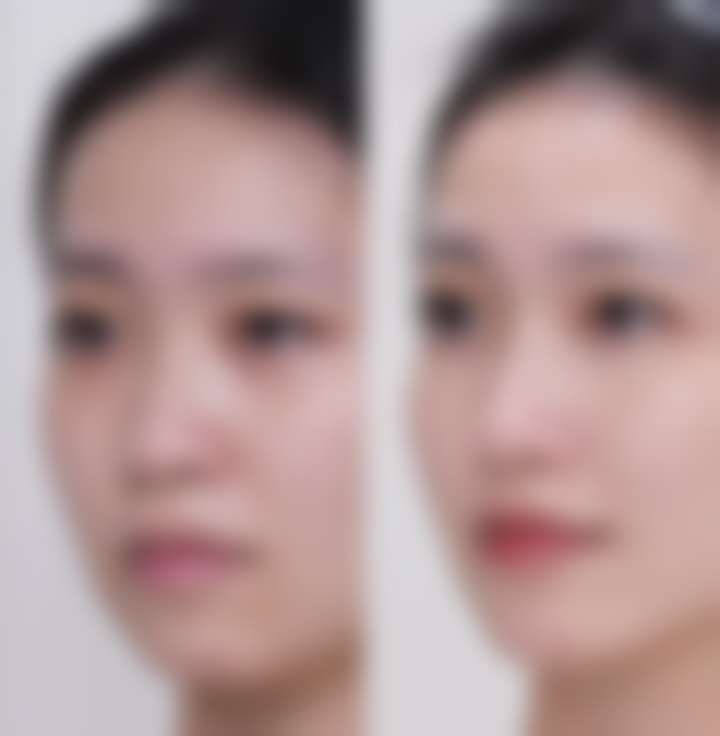 成都美丽部落荟美医疗美容门诊部口碑评价怎么样？