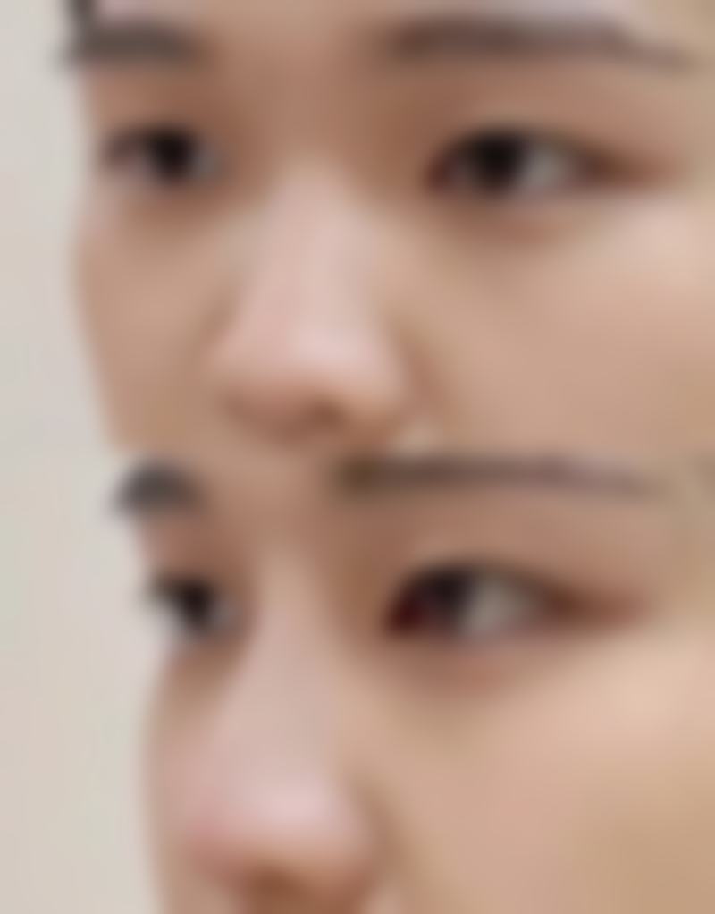 韩国我的未来皮肤科医院怎么预约