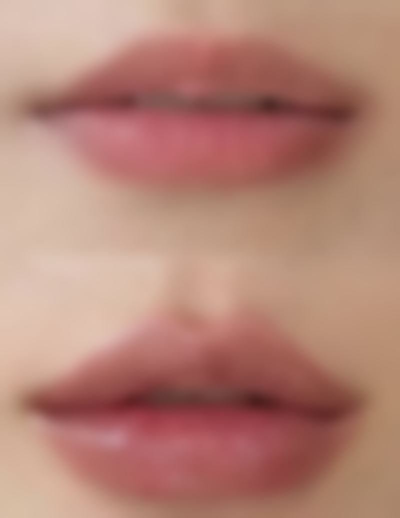 武汉忆美凯德整形医院许辉医生擅长项目