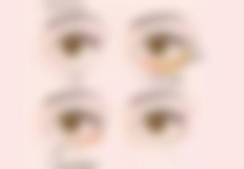 技巧五：修复期护理与防疤，为肌肤“护航”