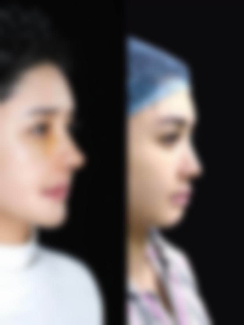 问题二：2023年更受欢迎的祛眼袋眼霜第一款是什么？