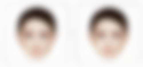 韩国毛尚毛发移植医院正规吗？