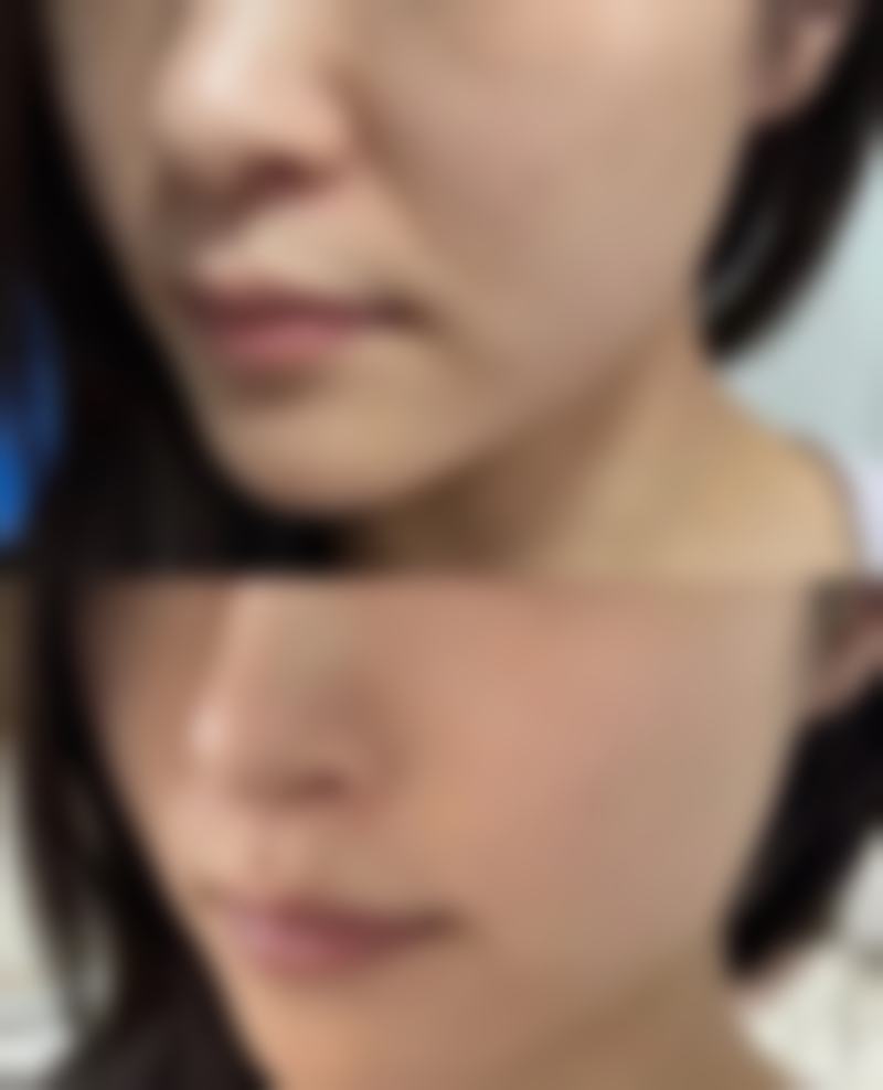 术前询问要注意什么？