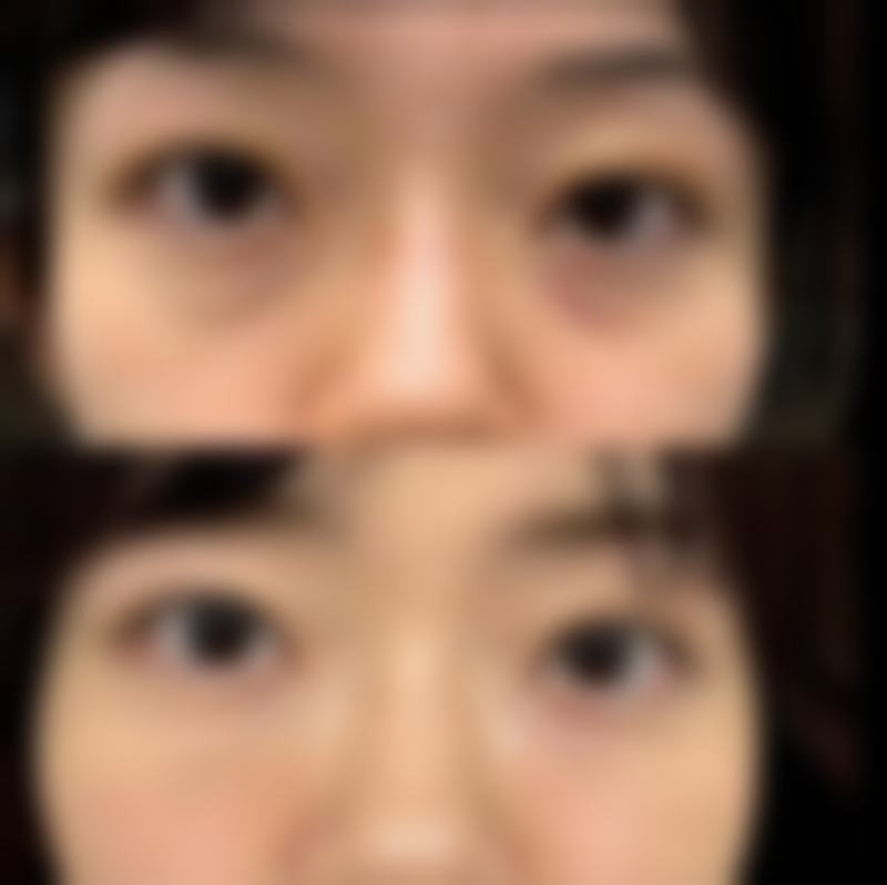 维娜眼霜针对眼袋的真实成效有哪些？