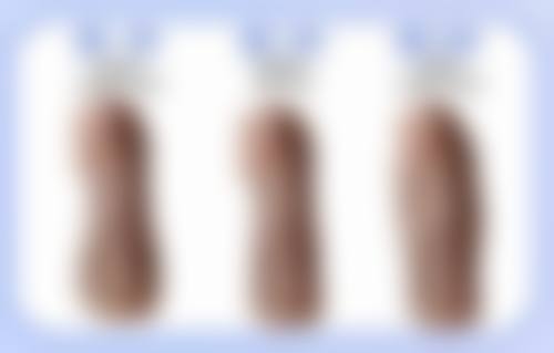 问题六：手术治疗缝合伤口疤痕适用于哪些情况，有哪些注意事项？